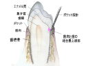 健康な歯肉の断面像