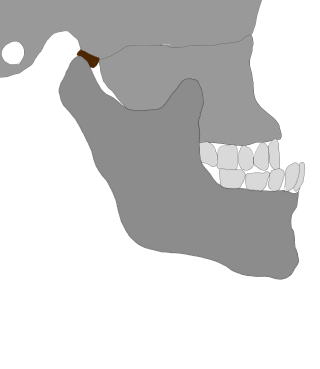 関節円板前方転位した下顎の前方運動時時